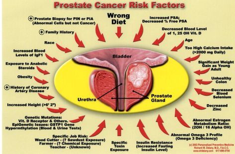 Prostate Health: Understanding Risk Factors and Prevention